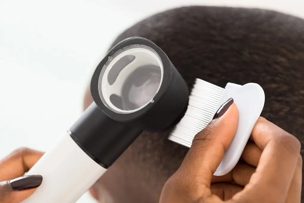 How Long Can Lice Live? LiceDoctors